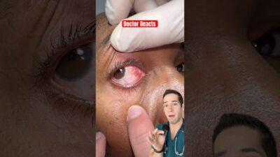 What’s in their eye?!